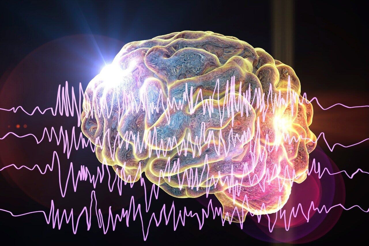 Convuls O O Que Causas E Sinais De Uma Crise Neurofisio Db